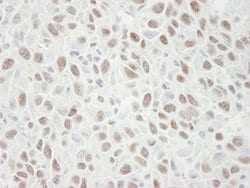 MCM4 Polyclonal Antibody, Bethyl Laboratories 10 &mu;L; Unconjugated:Antibodies,