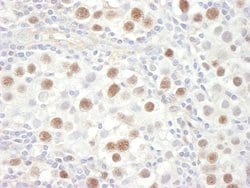 MCM4 Polyclonal Antibody, Bethyl Laboratories 100 &mu;L; Unconjugated:Antibodies,