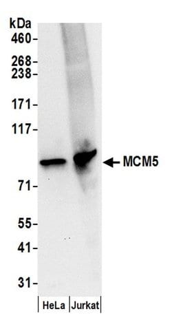 MCM5 Polyclonal Antibody, Bethyl Laboratories 20 &mu;L; Unconjugated:Antibodies,