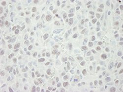 MCM5 Polyclonal Antibody, Bethyl Laboratories 10 &mu;L | Buy Online | Bethyl Laboratories, Inc | Fisher Scientific