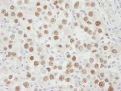 MCM5 Polyclonal Antibody, Bethyl Laboratories 10 &mu;L | Buy Online | Bethyl Laboratories, Inc | Fisher Scientific