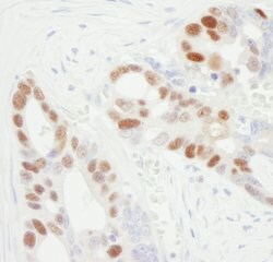 MCM6 Goat anti-Human, Polyclonal, Bethyl Laboratories 100 &mu;l; Unlabeled:Antibodies,