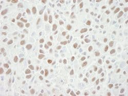 MCM6 Polyclonal Antibody, Bethyl Laboratories 10 &mu;L | Buy Online | Bethyl Laboratories, Inc | Fisher Scientific