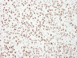 MCM6 Polyclonal Antibody, Bethyl Laboratories 10 &mu;L; Unconjugated:Antibodies,