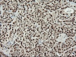 MCTS1 Mouse anti-Human, Clone: OTI2F9, liquid, TrueMAB 100 &mu;L; Unconjugated:Antibodies,