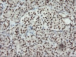 MCTS1 Monoclonal Antibody (OTI 5B5), TrueMAB , OriGene 30 &mu;L; Unconjugated:Antibodies,