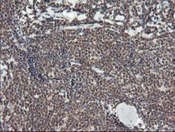 MCTS1 Monoclonal Antibody (OTI 5B5), TrueMAB , OriGene 30 &mu;L; Unconjugated:Antibodies,