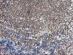 MCTS1 Monoclonal Antibody (OTI 5B5), TrueMAB , OriGene 30 &mu;L; Unconjugated:Antibodies,