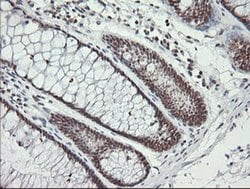 MCTS1 Monoclonal Antibody (OTI 5B5), TrueMAB , OriGene 30 &mu;L; Unconjugated:Antibodies,