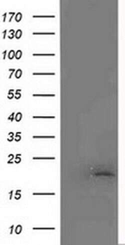 MCTS1 Mouse anti-Human, Clone: OTI2F9, liquid, TrueMAB 100 &mu;L; Unconjugated:Antibodies,