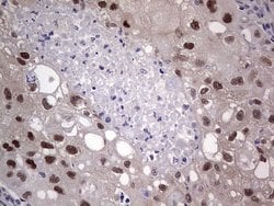 MDM2 Monoclonal Antibody (OTI8C6), TrueMAB , OriGene 100 &mu;L; Unconjugated:Antibodies,