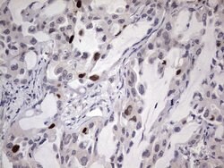 MDM2 Monoclonal Antibody (OTI22D6), TrueMAB , OriGene 100 &mu;L; Unconjugated:Antibodies,