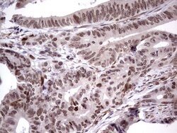 MDM2 Monoclonal Antibody (OTI22D6), TrueMAB , OriGene 100 &mu;L; Unconjugated:Antibodies,