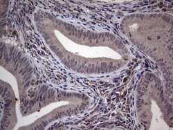MDM2 Monoclonal Antibody (OTI3F1), TrueMAB , OriGene 100 &mu;L; Unconjugated:Antibodies,