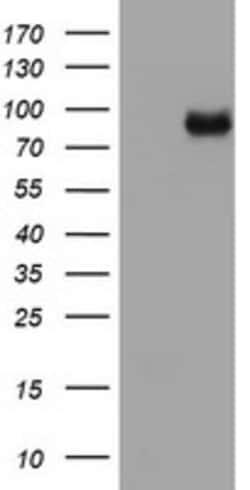MDM2 Mouse anti-Human, Clone: OTI1B4, lyophilized, TrueMAB 100 &mu;g; Unconjugated:Antibodies,