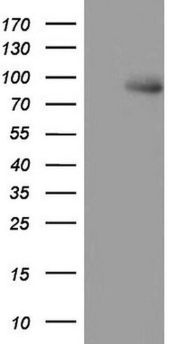 MDM2 Monoclonal Antibody (OTI4E5), TrueMAB , OriGene 100 &mu;L; Unconjugated:Antibodies,