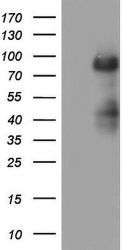 MDM2 Monoclonal Antibody (OTI6H3), TrueMAB , OriGene:Antibodies:Primary