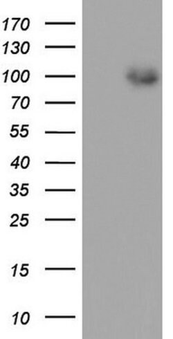 MDM2 Monoclonal Antibody (OTI22D6), TrueMAB , OriGene 100 &mu;L; Unconjugated:Antibodies,