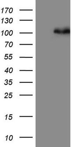 MDM2 Monoclonal Antibody (OTI3F1), TrueMAB , OriGene 100 &mu;L; Unconjugated:Antibodies,