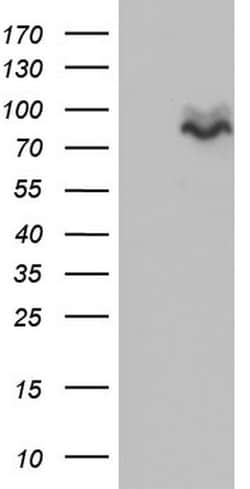 MDM2 Monoclonal Antibody (OTI20D1), TrueMAB , OriGene:Antibodies:Primary
