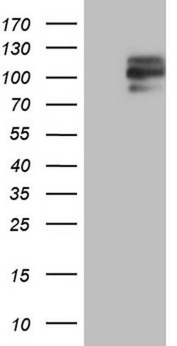 MDM2 Monoclonal Antibody (OTI15C5), TrueMAB , OriGene:Antibodies:Primary