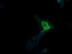 MDM4 Monoclonal Antibody (OTI2B8), TrueMAB , OriGene 100 &mu;L; Unconjugated:Antibodies,