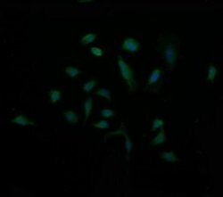 MDM4 Monoclonal Antibody (OTI4D2), TrueMAB , OriGene 100 &mu;L; Unconjugated:Antibodies,
