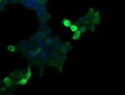 MDM4 Monoclonal Antibody (OTI4B10), TrueMAB , OriGene:Antibodies:Primary