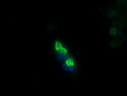 MDM4 Monoclonal Antibody (OTI2D11), TrueMAB , OriGene 100 &mu;L; Unconjugated:Antibodies,