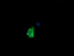 MDM4 Monoclonal Antibody (OTI2C1), TrueMAB , OriGene:Antibodies:Primary