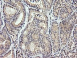 MDM4 Monoclonal Antibody (OTI3B9), TrueMAB , OriGene 100 &mu;L; Unconjugated:Antibodies,