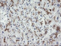 MDM4 Monoclonal Antibody (OTI3A6), TrueMAB , OriGene:Antibodies:Primary