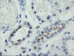 MDM4 Monoclonal Antibody (OTI4G3), TrueMAB , OriGene 100 &mu;L; Unconjugated:Antibodies,