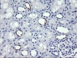 MDM4 Monoclonal Antibody (OTI3H2), TrueMAB , OriGene:Antibodies:Primary