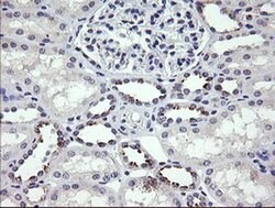 MDM4 Monoclonal Antibody (OTI2D11), TrueMAB , OriGene 100 &mu;L; Unconjugated:Antibodies,