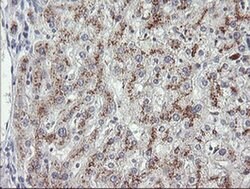 MDM4 Monoclonal Antibody (OTI2D11), TrueMAB , OriGene 100 &mu;L; Unconjugated:Antibodies,