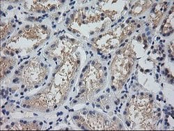 MDM4 Monoclonal Antibody (OTI2E11), TrueMAB , OriGene 100 &mu;L; Unconjugated:Anticuerpos