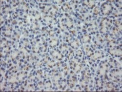 MDM4 Monoclonal Antibody (OTI2C1), TrueMAB , OriGene:Antibodies:Primary