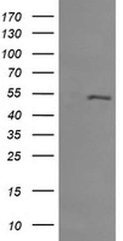 MDM4 Monoclonal Antibody (OTI2B8), TrueMAB , OriGene 100 &mu;L; Unconjugated:Antibodies,