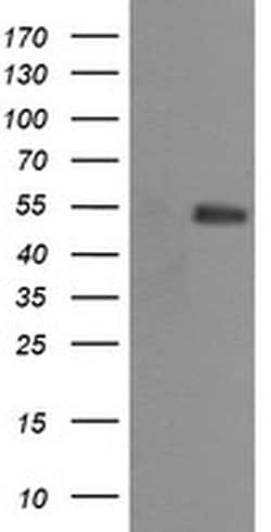 MDM4 Monoclonal Antibody (OTI4E10), TrueMAB , OriGene:Antibodies:Primary