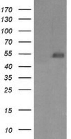 MDM4 Mouse anti-Human, Clone: OTI1D11, lyophilized, TrueMAB 100 &mu;g;