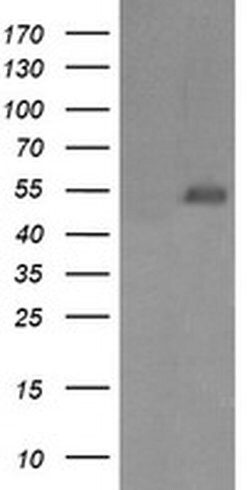 MDM4 Monoclonal Antibody (OTI1D11), TrueMAB , OriGene 100 &mu;L; Unconjugated:Antibodies,