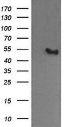 MDM4 Mouse anti-Human, Clone: OTI3B9, lyophilized, TrueMAB 100 &mu;g | Buy Online | Origene Technologies | Fisher Scientific