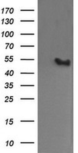 MDM4 Monoclonal Antibody (OTI3B9), TrueMAB , OriGene 100 &mu;L; Unconjugated:Antibodies,
