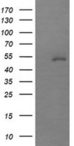 MDM4 Mouse anti-Human, Clone: OTI3A6, lyophilized, TrueMAB 100 &mu;g; Unconjugated:Antibodies,