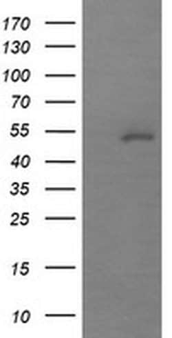 MDM4 Monoclonal Antibody (OTI3A6), TrueMAB , OriGene:Antibodies:Primary