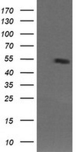MDM4 Monoclonal Antibody (OTI4G3), TrueMAB , OriGene 100 &mu;L; Unconjugated:Antibodies,