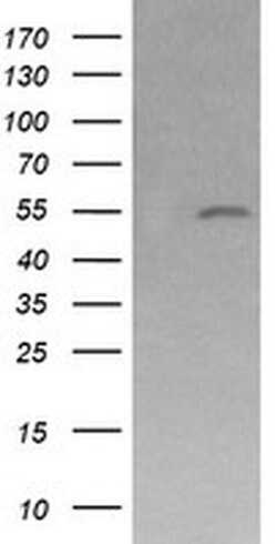 MDM4 Monoclonal Antibody (OTI4D2), TrueMAB , OriGene 100 &mu;L; Unconjugated:Antibodies,