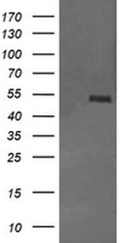 MDM4 Monoclonal Antibody (OTI1E8), TrueMAB , OriGene 100 &mu;L | Buy Online | Origene Technologies | Fisher Scientific
