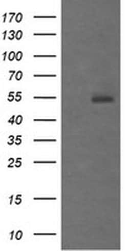 MDM4 Monoclonal Antibody (OTI4B10), TrueMAB , OriGene 100 &mu;L; Unconjugated:Antibodies,